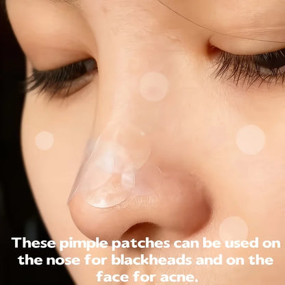 200/400/800PCS ultra-thin water-based gel acne patches, leaving no trace on the skin, with long-lasting adhesion and no residue.